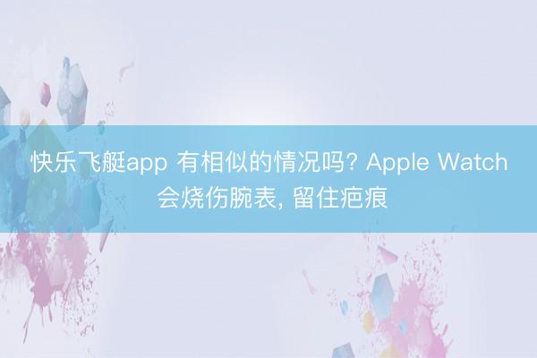 快乐飞艇app 有相似的情况吗? Apple Watch 会烧伤腕表, 留住疤痕